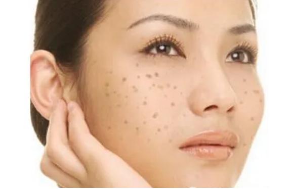 脸上起红斑块用什么草药,脸上起斑块中医如何调理