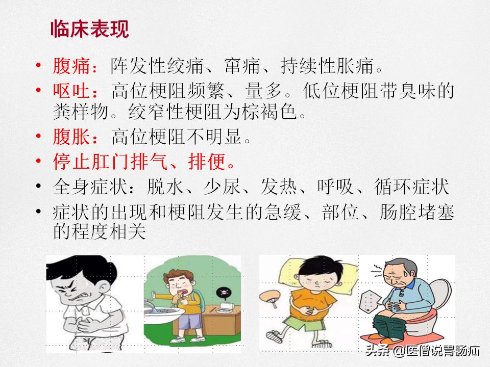 肠梗阻健康教育,肠梗阻患者的健康宣教