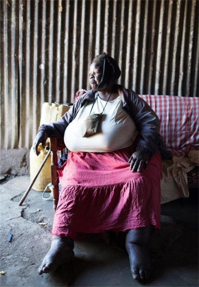 非洲有一体重300斤的“美女苏珊”,2000年,丈夫辞职在家陪妻子