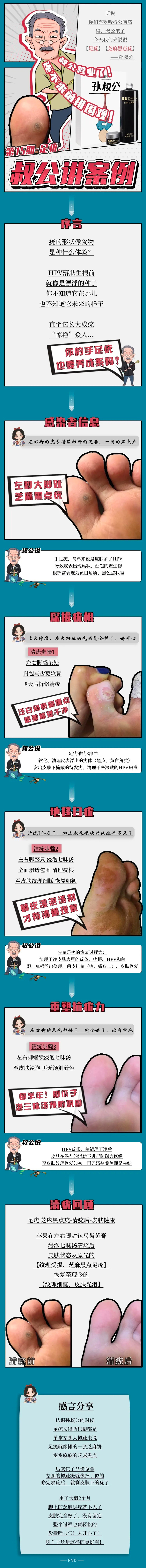 足疣周围都是黑点点,足疣形成的原因