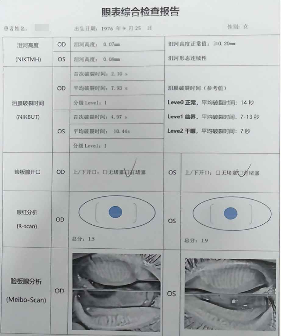 手机玩多了眼睛干涩流泪视力模糊,看手机眼睛干涩流泪如何解决