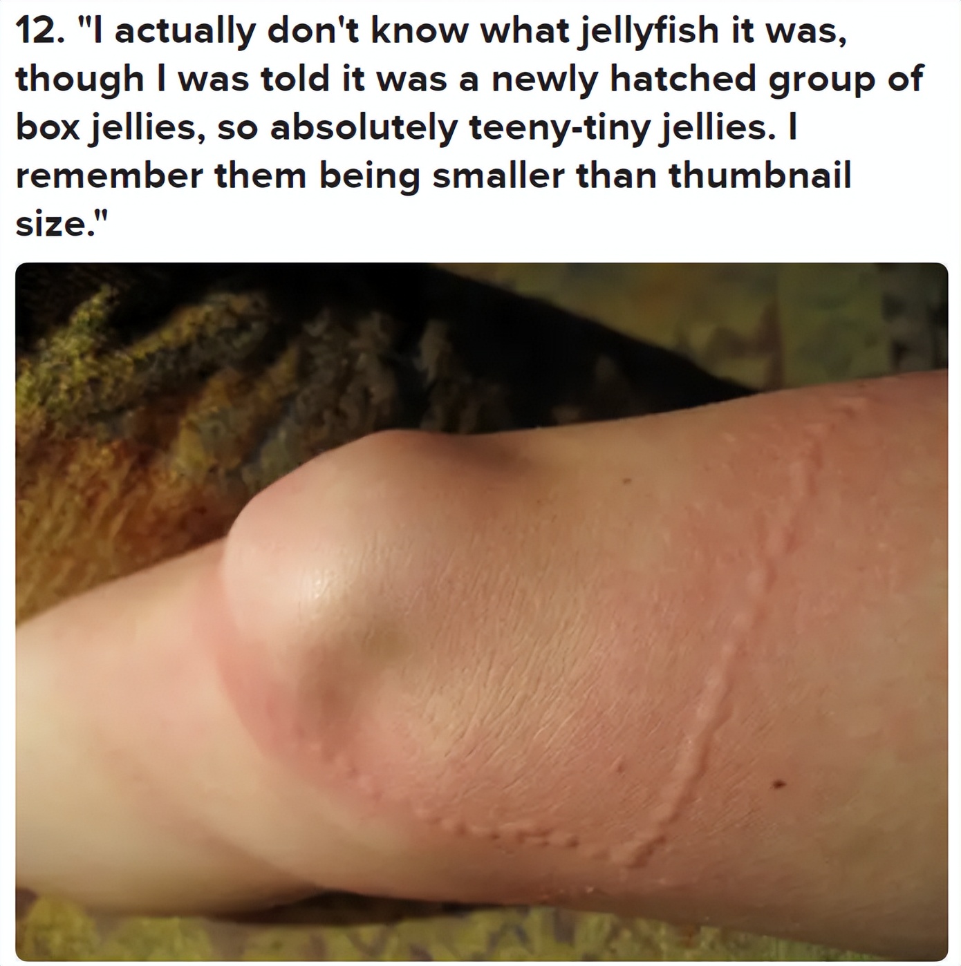 被毒的动物咬了会发生什么,亲身体验被有毒的动物咬