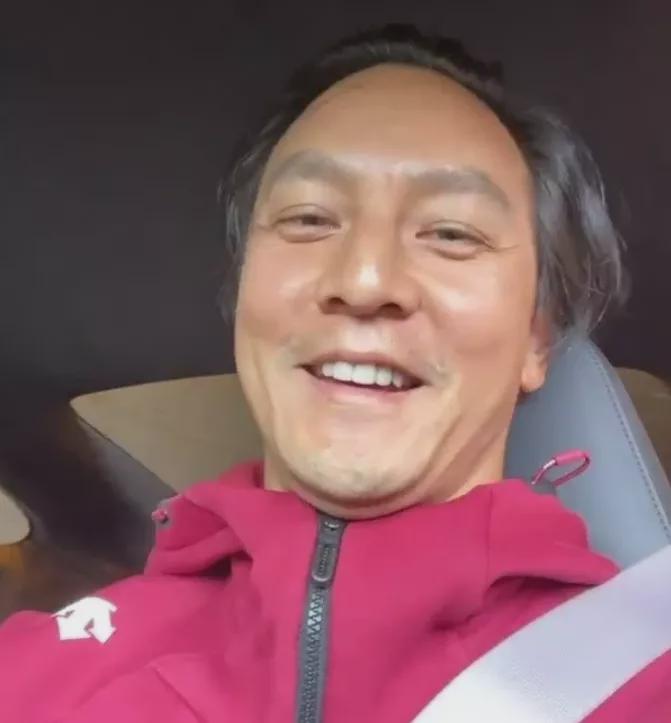 明星如何解决脱发问题,明星也扛不住脱发