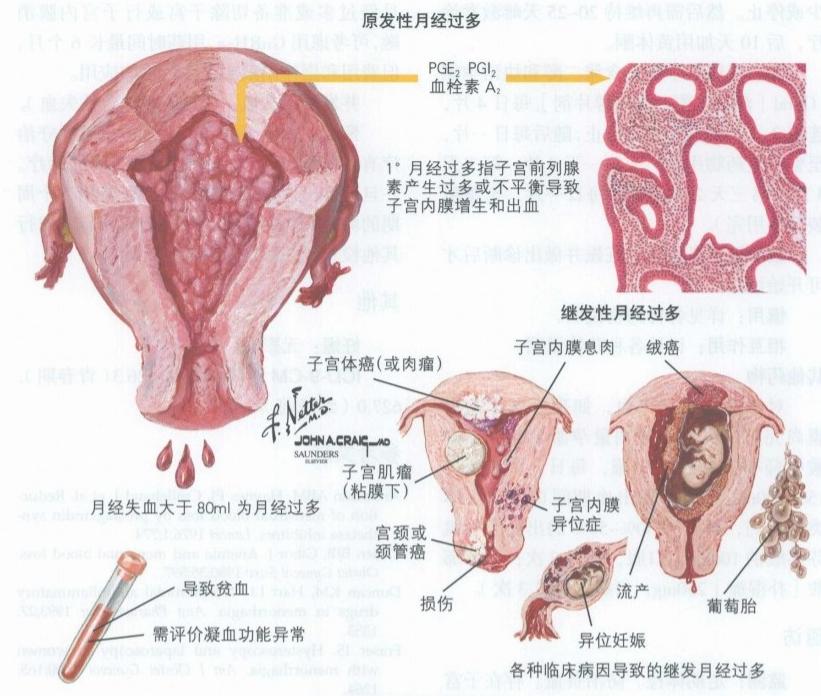 月经淋漓不尽怎么判断来月经,每次月经都有特别多血块