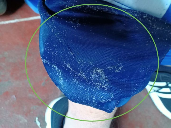 洗完澡身上痒还起皮是怎么回事,洗完澡皮肤干燥起皮浑身痒