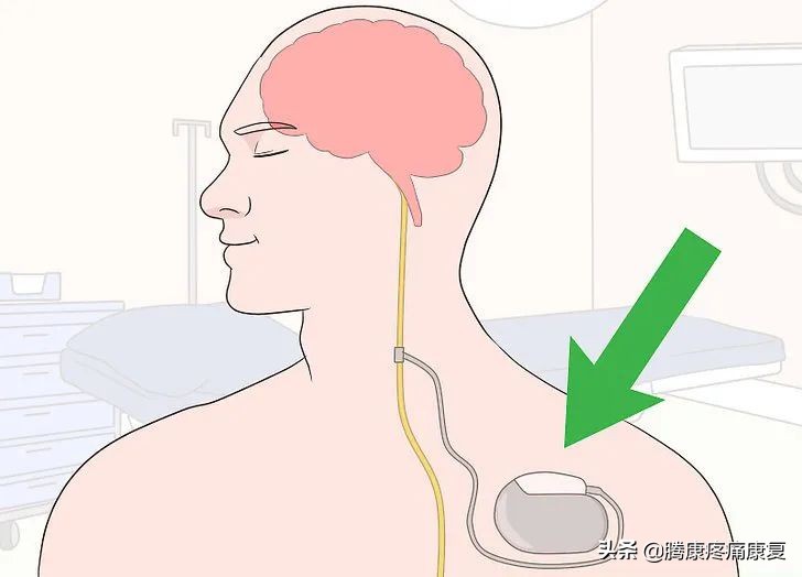 这个神经对身体影响巨大，经常被忽略，怎么刺激才能更健康？