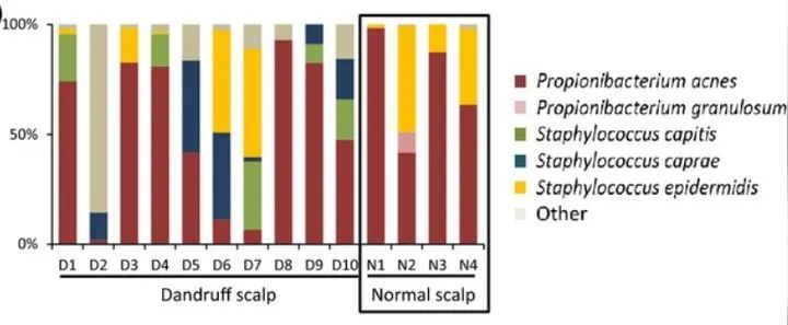 头皮特别痒还结硬痂有大块头屑,头皮头屑多掉发按手上什么穴位