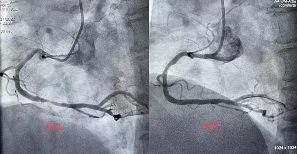 沈阳医学院附属第二医院:牛年岁尾,让胸痛患者安稳过除夕
