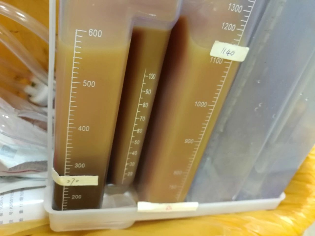 婴儿先天性心脏病怎么护理,婴儿先天性心脏病做什么手术好