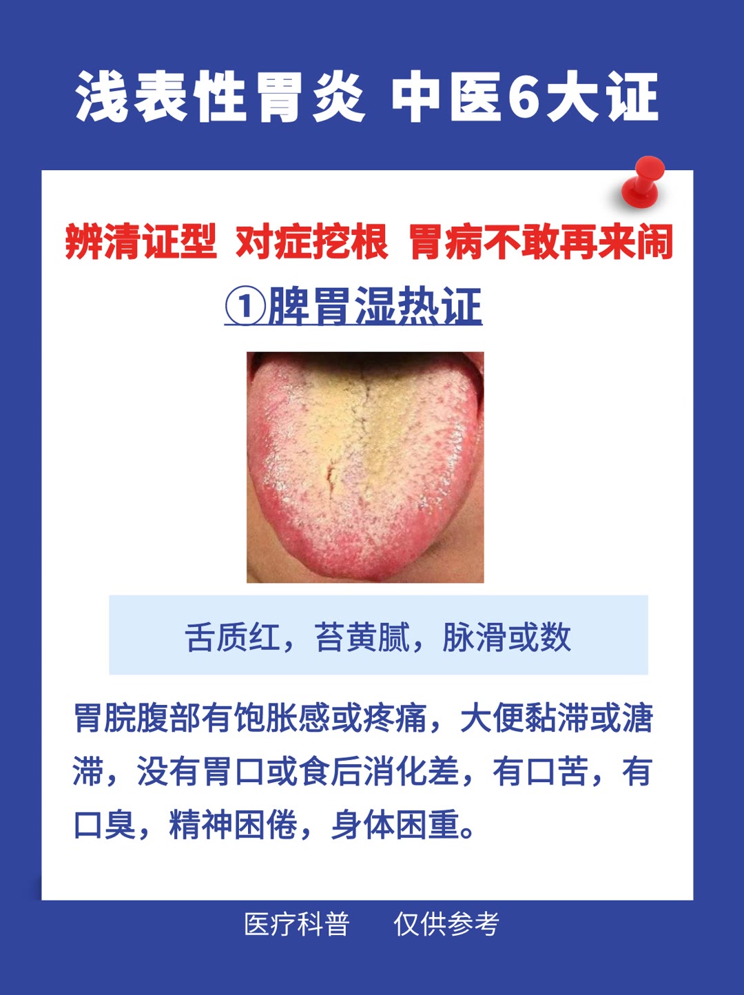 慢性浅表性胃炎中医治疗药方,浅表性胃炎中医判断