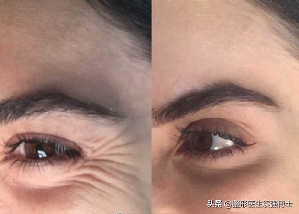 40岁以后要选择什么样的医美项目,40岁医美行业能干什么