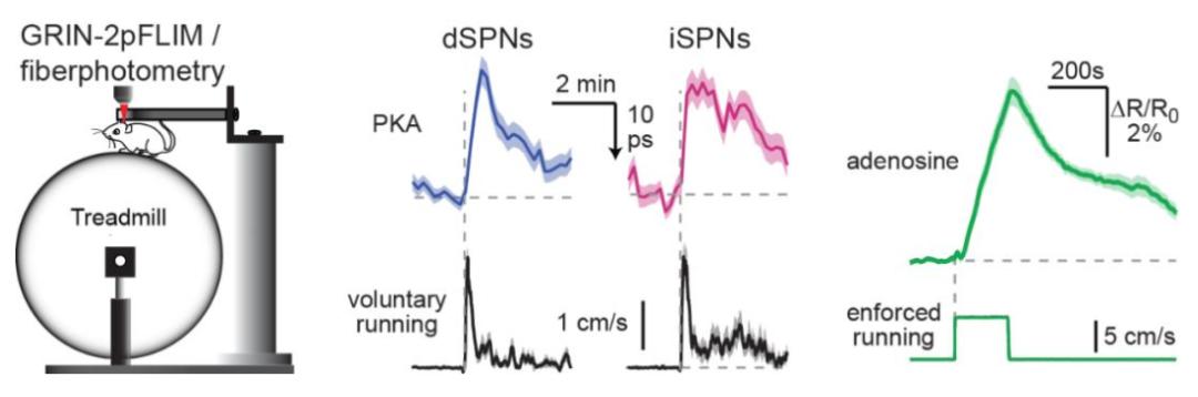为治疗帕金森病带来新方法，北大发现大脑控制运动的“刹车”机制