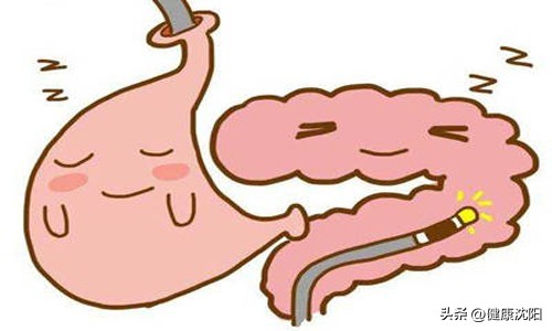 护胃健康从胃镜检查开始,国际护胃日浅表性胃炎