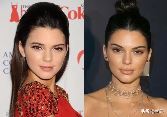 虽然知道她对丰唇很执着，但美女不要再乱折腾了