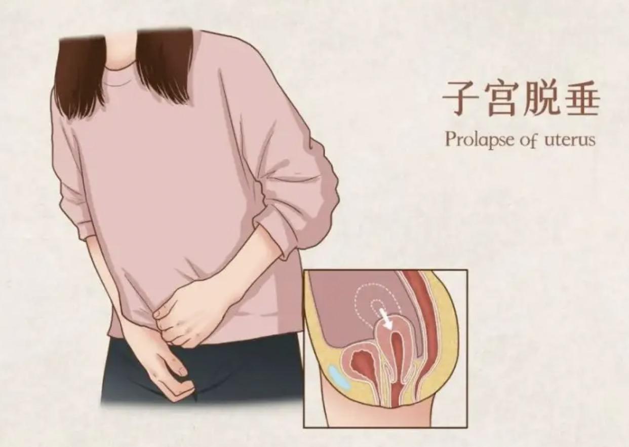 痛苦的疾病治疗,几种不需要治疗的妇科疾病