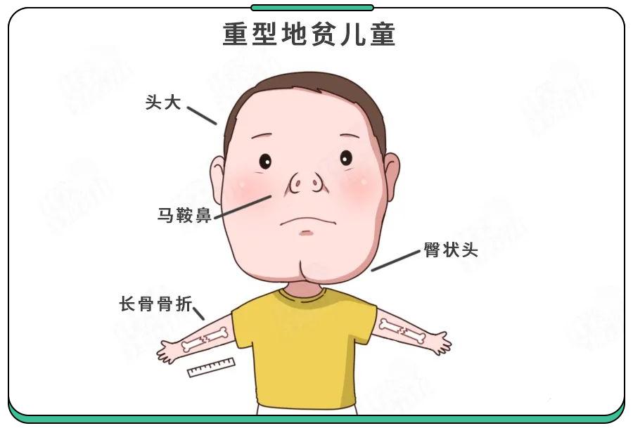 70岁老人为救孙女每天扛20吨草料,20岁才发现地贫还能治吗