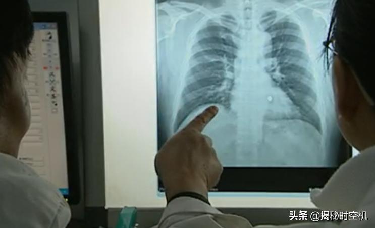 中国孤例！*弹子**击中心脏14年没死？湖南男子奇迹生还至今成谜