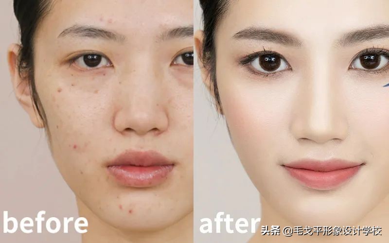 凹陷疤痕修容,菱形方脸脸颊凹陷怎么修容