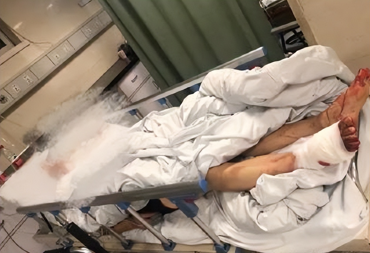 回顾杭州母女被4只烈性犬咬至休克，狗主人叫嚣：有本事你告我啊