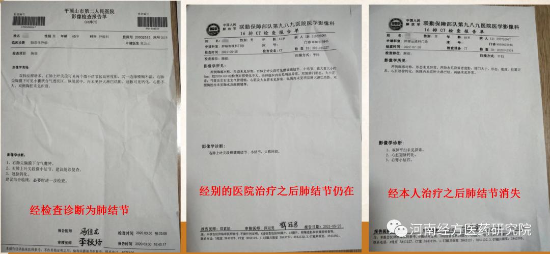 甲状腺结节乳腺增生经方案例,王付教授谈结节