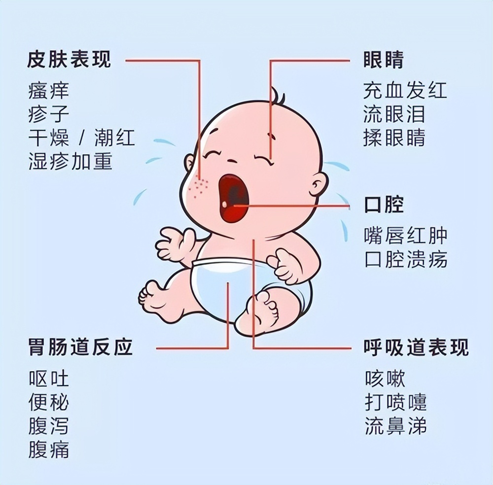 儿童皮肤过敏能不能吃油炸食物,鸡蛋白牛奶过敏不能吃哪些食物