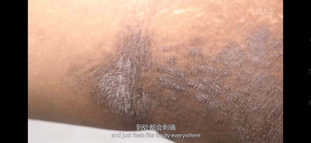 跟着皮肤科医生学英语