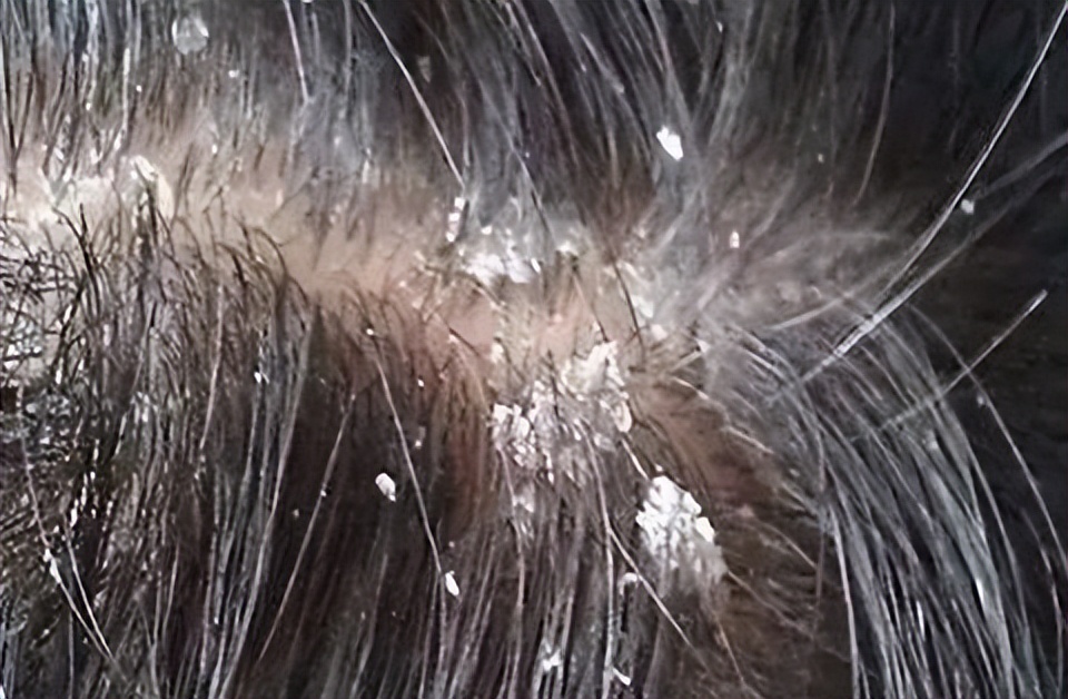 最好用的生发液推荐,生发液国货