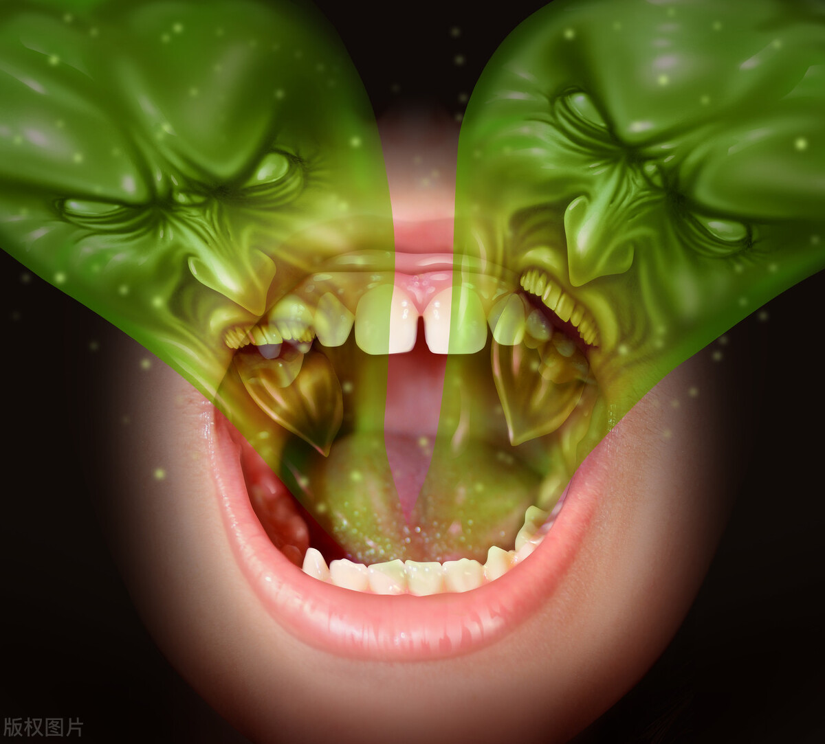 为什么牙结石有时候会自己掉,已经形成的牙结石怎么去除