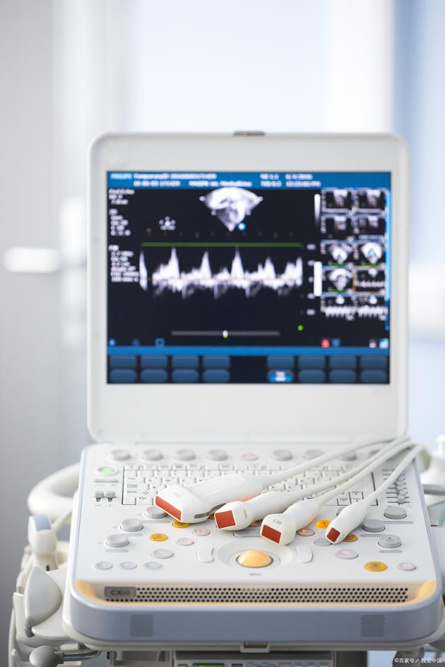 主动脉瓣狭窄是什么引起的,70岁高血压患者主动脉瓣重度狭窄