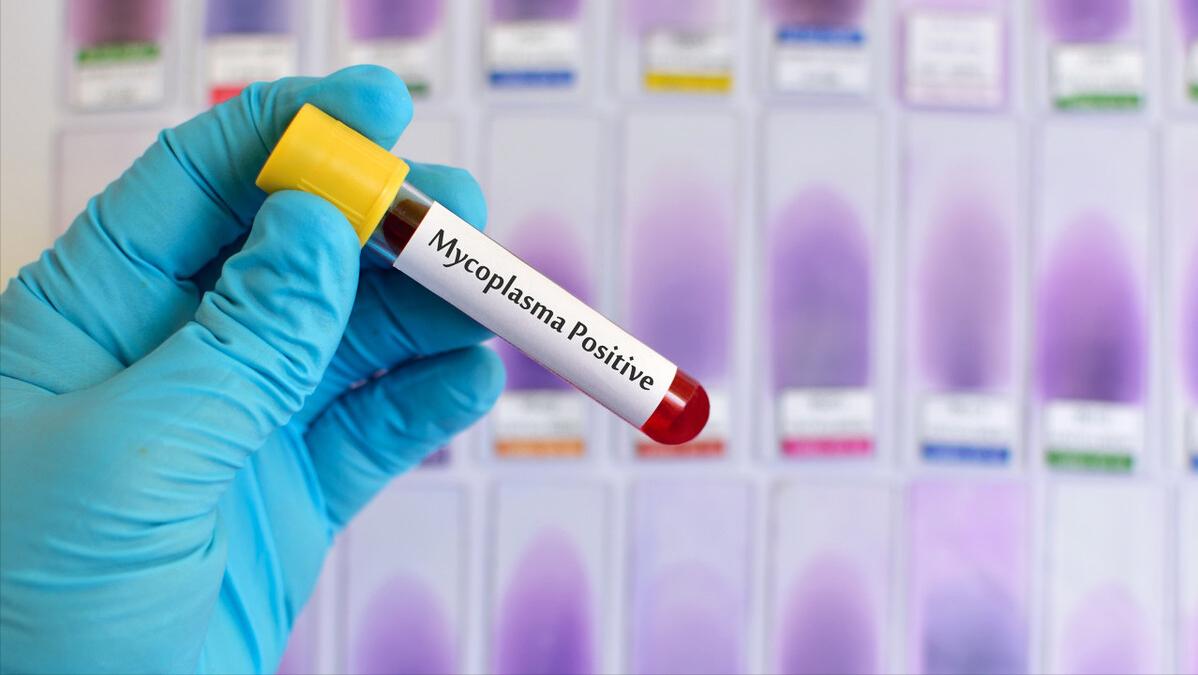 男性解脲支原体阳性影响备孕吗,夫妻有支原体阳性会影响怀孕吗