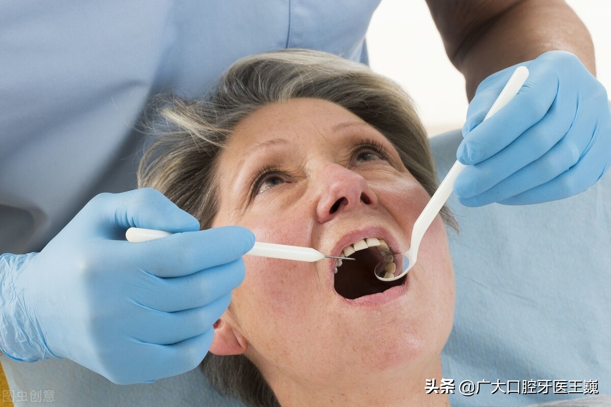 牙齿黑三角治疗最好的方法,牙齿黑三角怎么修复最简单方法