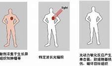 光动力治疗癌症是真的吗,光动力能治疗癌症吗
