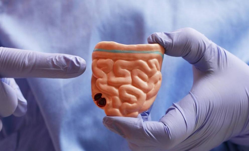 阿莫西林和头孢哪个对身体危害大,世界上两大抗生素阿莫西林和头孢