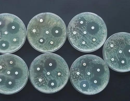 尿常规正常，没有尿痛，淋球菌检查却阳性！为何他的淋病反复不愈