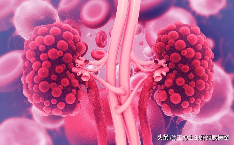 糖尿病肾病新药非奈利酮疗效如何,非奈利酮最新消息