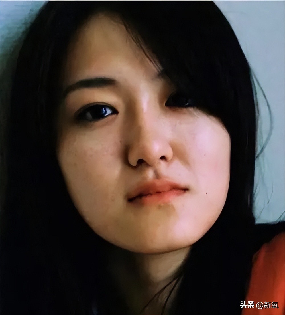 牙齿正畸和骨骼正畸的区别,牙齿正畸和眼轴增长有关系吗