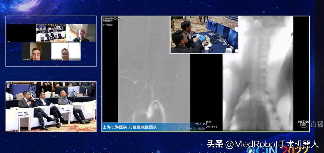 全球直播远程手术！爱博神经介入机器人闪耀东方脑血管病大会OCIN