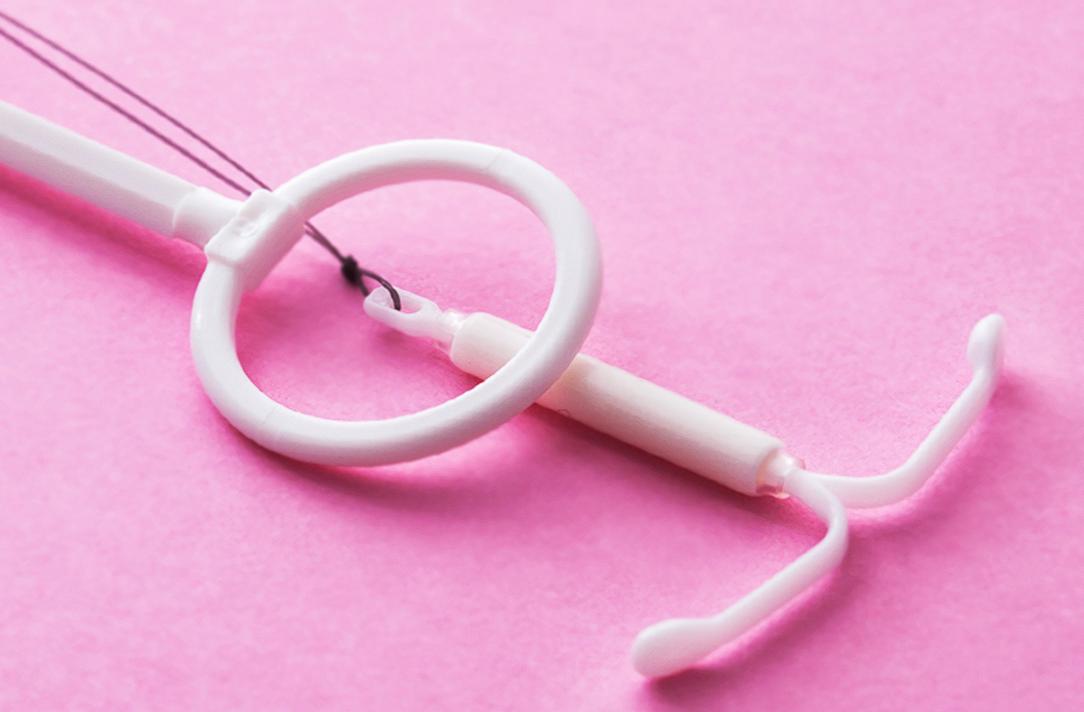 女性上环30年后的结局,以前上环的女性30多年后现状如何