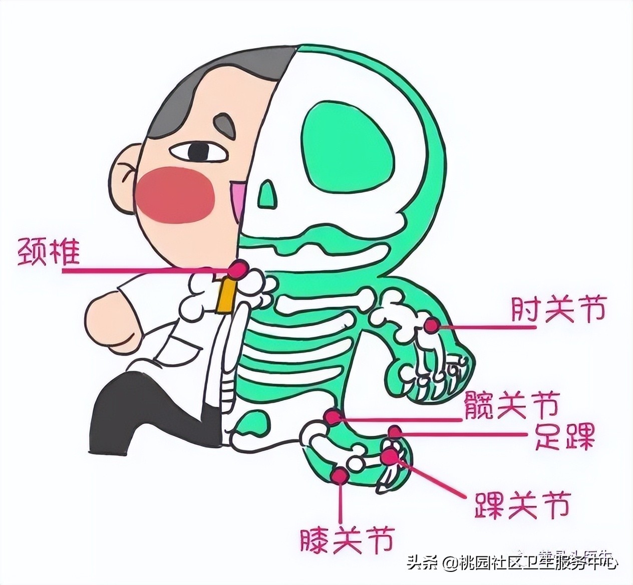 骨刺到底是什么样子的,骨刺究竟长在哪里