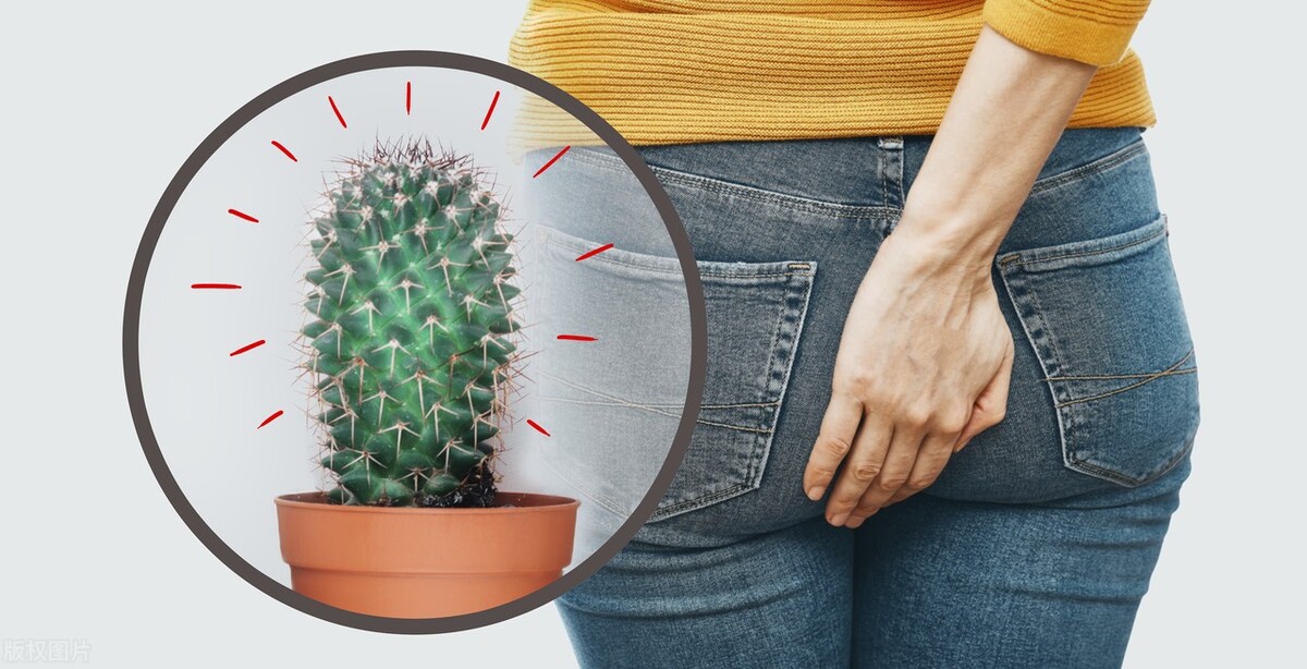 错把直肠癌当痔疮手术的后果,肛门癌与痔疮的症状和前兆