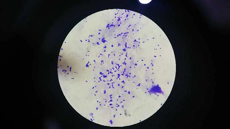 尿道炎有哪些症状？出现这些不适就得警惕了，可别大意