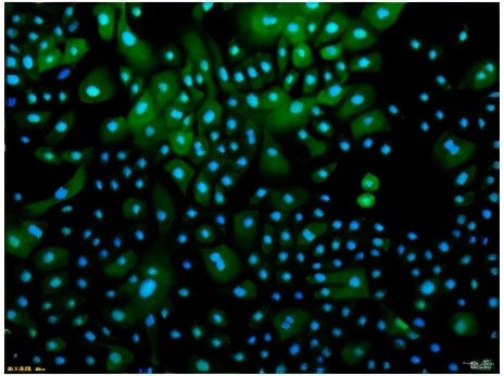 舒缓功效的成分,舒缓功效测试
