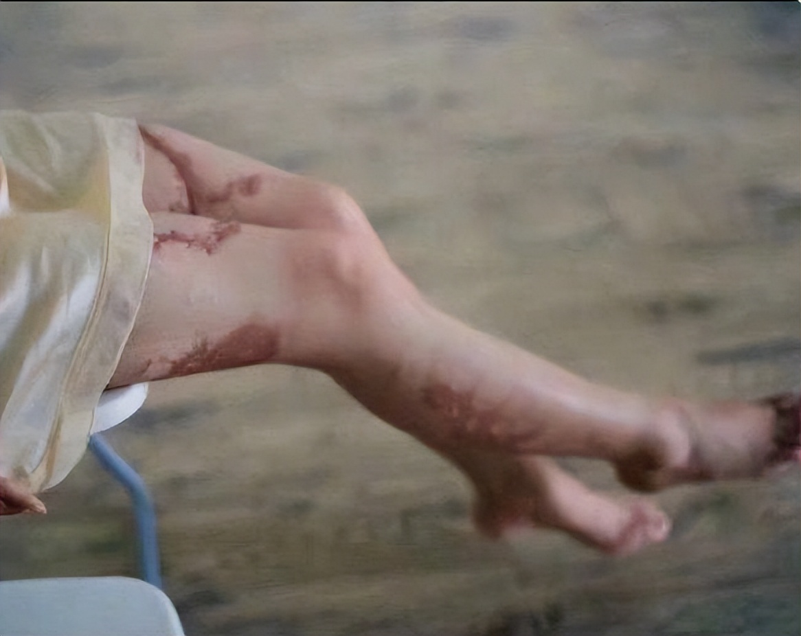 16岁女孩拒绝官二代求爱被毁容,拒绝富二代追求遭毁容以前照片