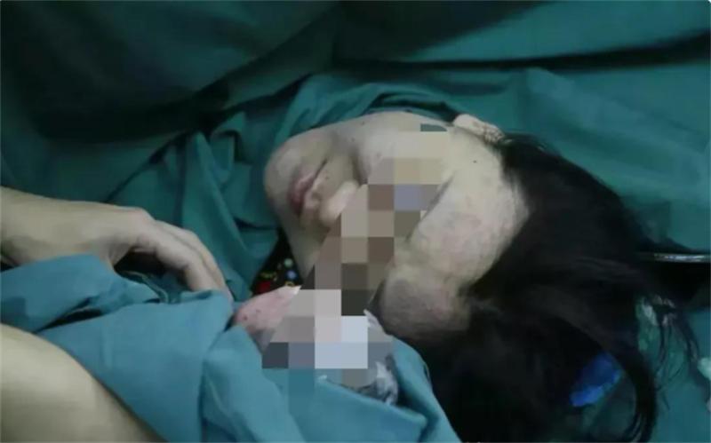 妈妈将子宫移植给孩子,2015年43岁母亲将子宫移植给女儿