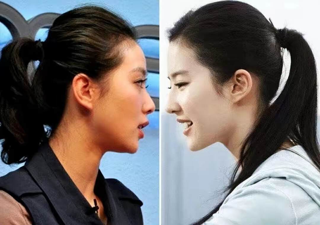 脸长适合高颅顶吗,什么脸型的人不适合高颅顶