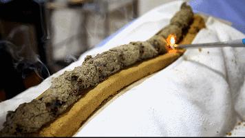 中医特色督脉灸，治疗多种慢性疾病！