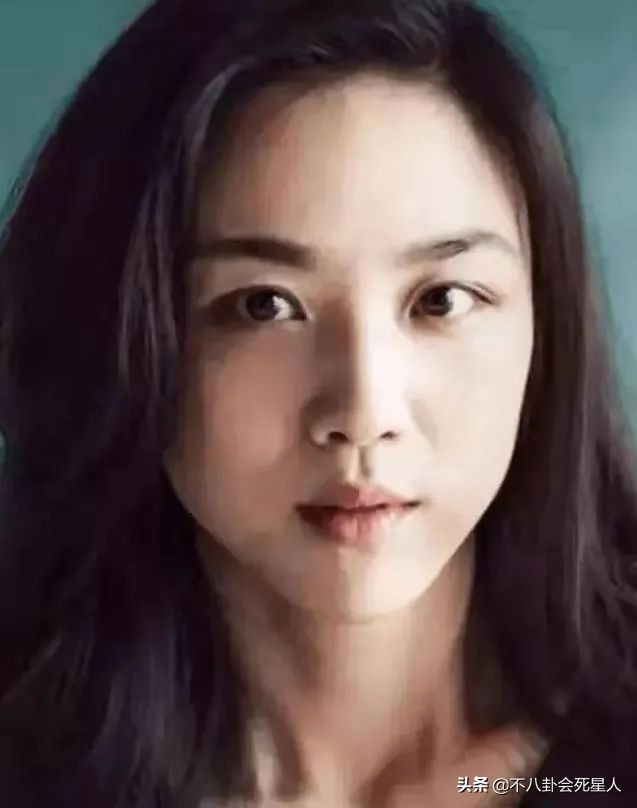 单眼斜视的明星,三白斗鸡眼