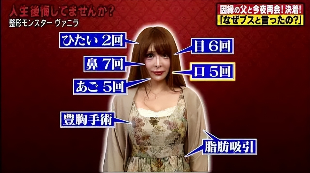 日本网红砸3亿整容上百次！整成法国娃娃：丑八怪在日本活不下去