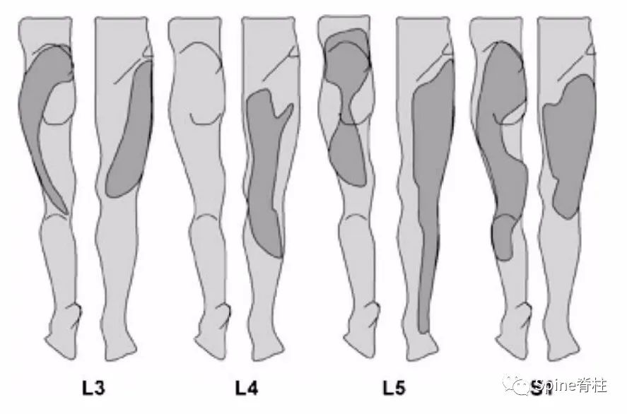 脊柱的神经支配,脊柱神经引起手臂疼痛