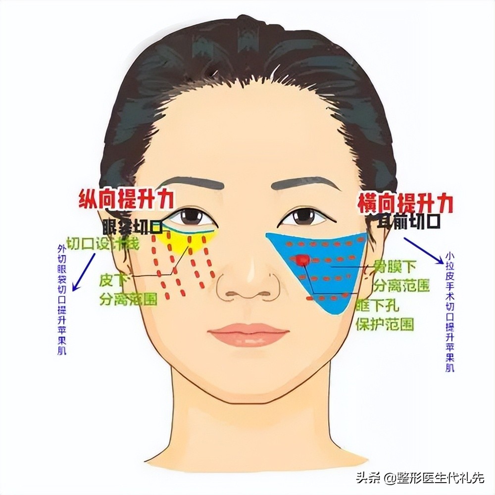 眼袋贴消除眼袋正品效果好,消除眼袋的方法有哪些